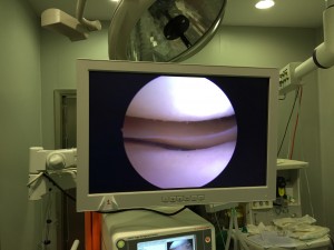 monitor-astroscopia-rodilla